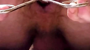 Overused hose enema and anal stretching