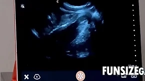 Ultra sound penetration chip - dr wolf, austin